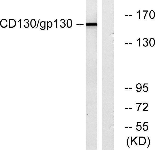 a01216 il6st primary antibodies wb testing 3