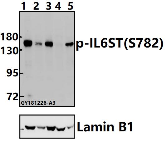 Western blot (WB) analysis of IL6ST (phospho-S782) polyclonal antibody at 1:500 dilution
Lane1:HEK293T whole cell lysate(40ug)
Lane2:SGC7901 whole cell lysate(40ug)
Lane3:L02 whole cell lysate(40ug)
Lane4:PC12 whole cell lysate(40ug)
Lane5:AML-12 whole cell lysate(40ug)