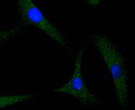 a01217 1 s100a4 primary antiboties icc testing 1