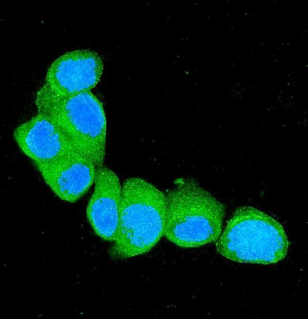 a01217 2 s100a4 primary antibodies if testing 6