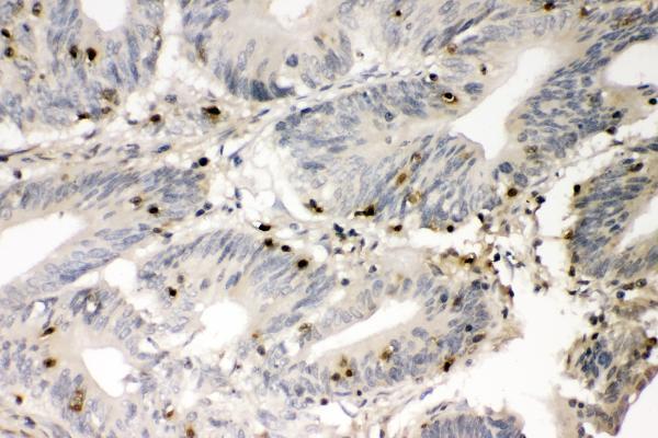  IHC analysis of S100A4 using anti-S100A4 antibody (A01217-2)