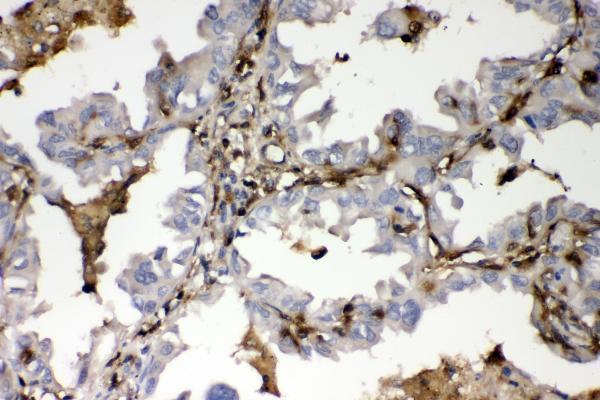  IHC analysis of S100A4 using anti-S100A4 antibody (A01217-2)