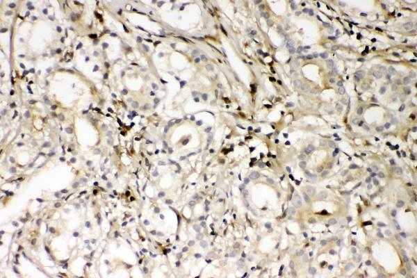 a01217 2 s100a4 primary antibodies ihc testing 4