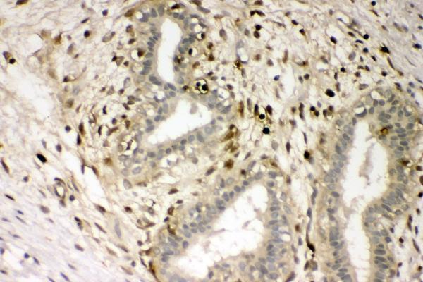 a01217 2 s100a4 primary antibodies ihc testing 5