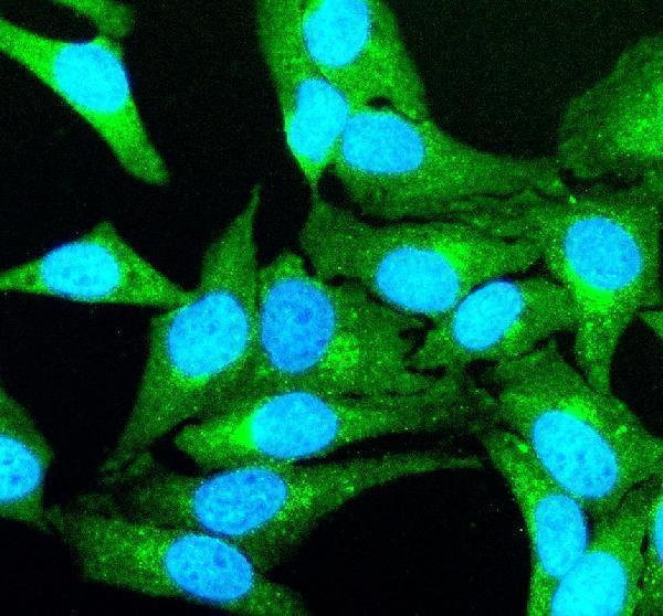 a01218 1 tgfbi primary antibodies if testing 1