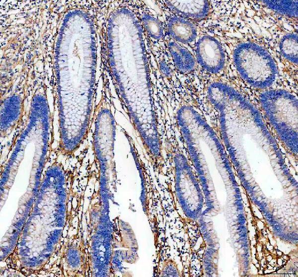 IHC analysis of BIGH3/TGFBI using anti-BIGH3/TGFBI antibody (A01218-1)