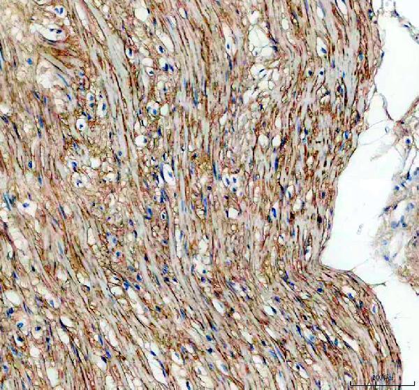 IHC analysis of BIGH3/TGFBI using anti-BIGH3/TGFBI antibody (A01218-1)