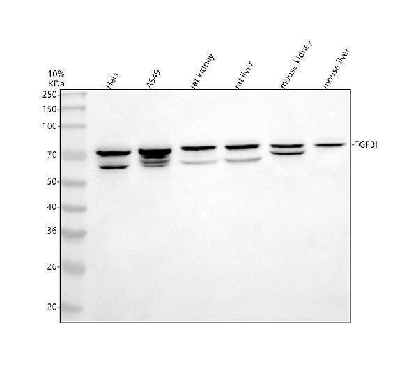 Western blot analysis of BIGH3/TGFBI using anti-BIGH3/TGFBI antibody (A01218-1)
