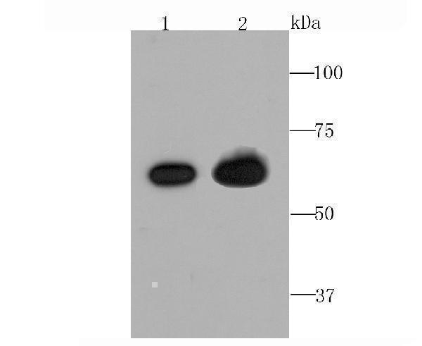 Western blot analysis of TGFBI on mouse colon (1) and mouse eye (2) tissue lysate using anti-TGFBI antibody at 1/1,000 dilution