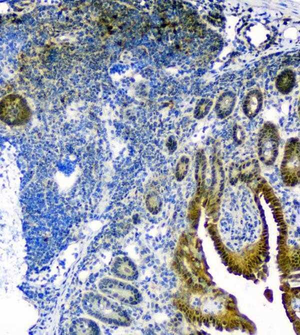  IHC analysis of Thioredoxin TRX using anti-Thioredoxin TRX antibody (A01219-1)