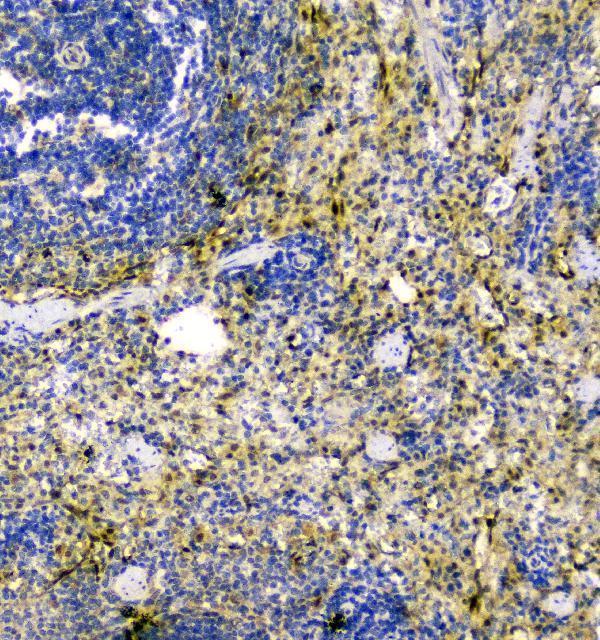  IHC analysis of Thioredoxin TRX using anti-Thioredoxin TRX antibody (A01219-1)
