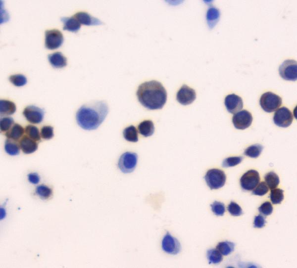 a01219 1 thioredoxin trx primary antibodies ihc testing 4