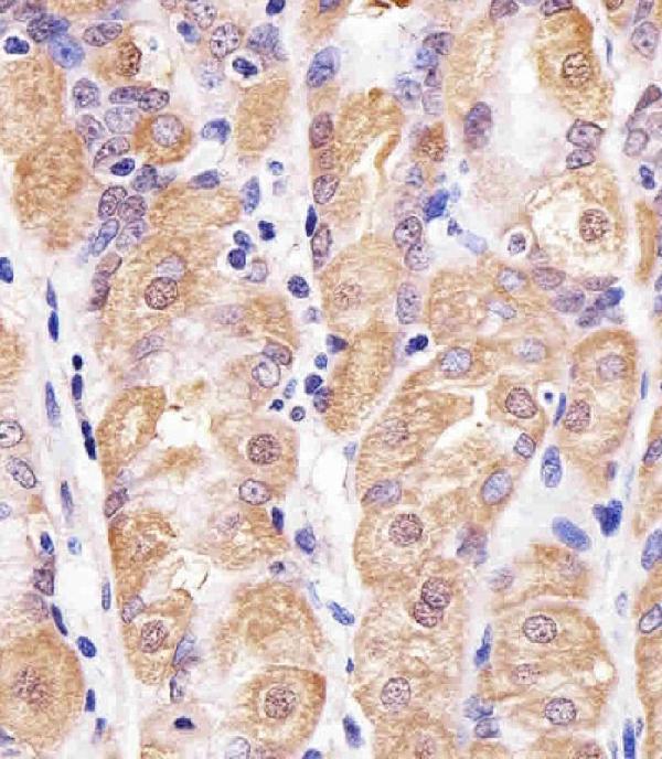 Immunohistochemical analysis of paraffin-embedded H. stomach section using TXN Antibody (C-term) (Cat#A01219). A01219 was diluted at 1:25 dilution. A undiluted biotinylated goat polyvalent antibody was used as the secondary, followed by DAB staining.