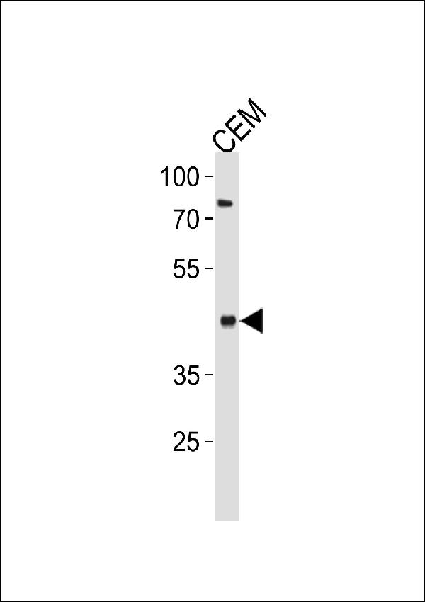 FADS2 Antibody (Center) western blot analysis in CEM cell line lysates (35ug/lane).This demonstrates the FADS2 antibody detected the FADS2 protein (arrow).
