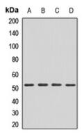 Western blot analysis of FADS2 expression in A549 (A), Hela (B), mouse liver (C), mouse brain (D) whole cell lysates