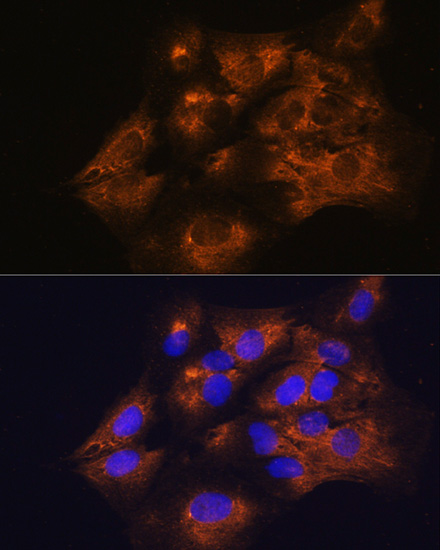 Immunofluorescence analysis of C6 cells using SERPING1 antibody  at dilution of 1:100