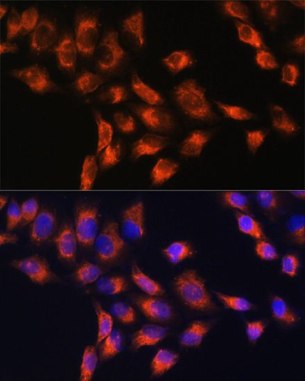 Immunofluorescence analysis of HeLa cells using SERPING1 antibody  at dilution of 1:100