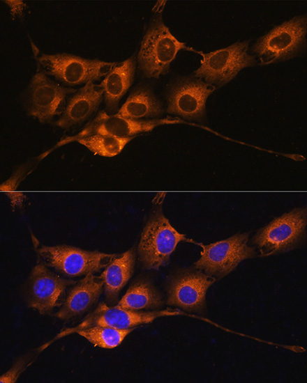 a01221 1 serping1 primary antiboties if testing 4