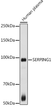 Western blot analysis of extracts of Human plasma, using SERPING1  antibody  at 1:1000 dilution