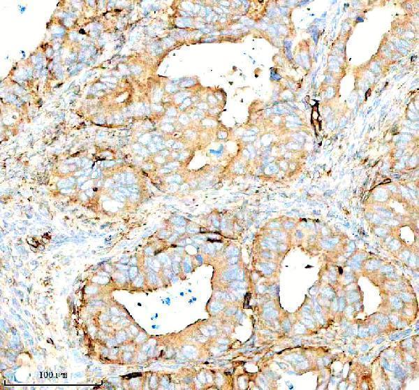  IHC analysis of Inactivator/SERPING1 using anti-Inactivator/SERPING1 antibody (A01221-3)