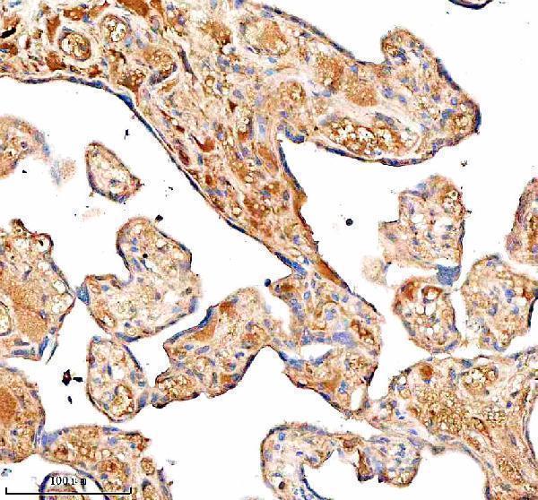  IHC analysis of Inactivator/SERPING1 using anti-Inactivator/SERPING1 antibody (A01221-3)