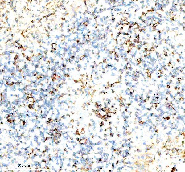  IHC analysis of Inactivator/SERPING1 using anti-Inactivator/SERPING1 antibody (A01221-3)