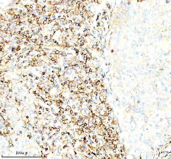 a01221 3 inactivator serping1 primary antibodies ihc testing 4