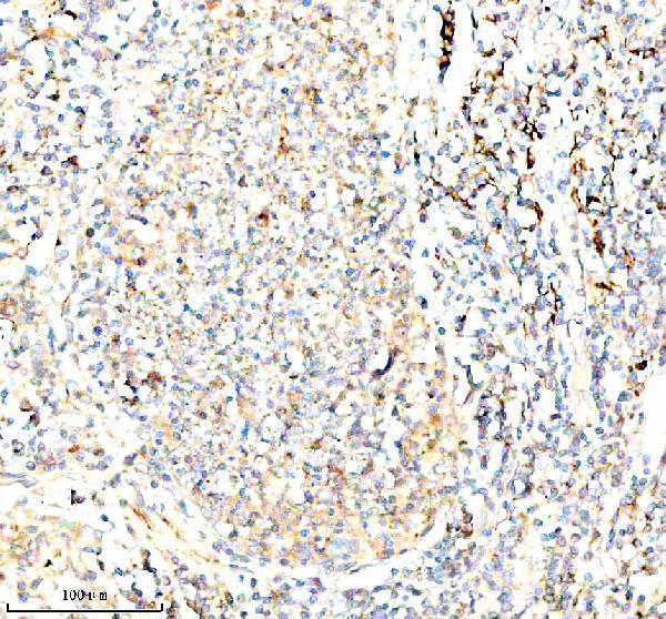 a01221 3 inactivator serping1 primary antibodies ihc testing 5