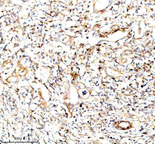 a01221 3 inactivator serping1 primary antibodies ihc testing 6