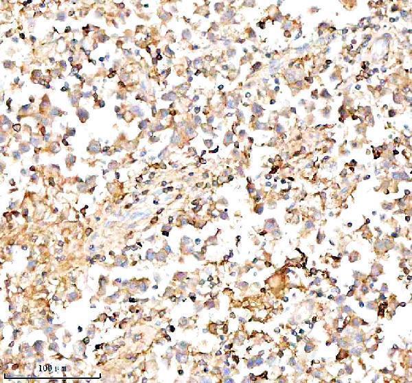 a01221 3 inactivator serping1 primary antibodies ihc testing 7