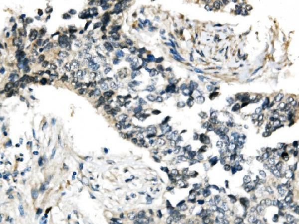 a01224 1 rnf168 primary antibodies ihc testing 2