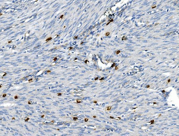 a01225 2 tnfrsf8 primary antibodies ihc testing 2