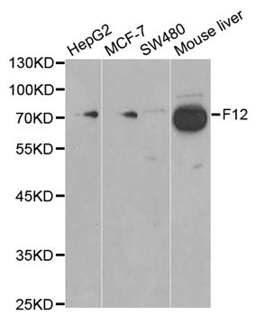 Western blot analysis of extracts of various cell lines, using F12 antibody  at 1:1000 dilution