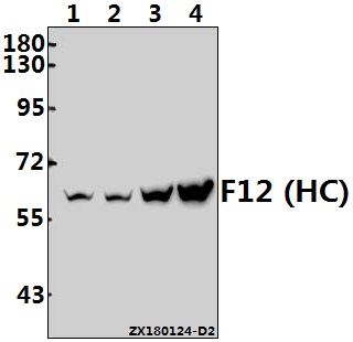 Western blot (WB) analysis of F12 (HC) pAb at 1:500 dilution
Lane1:L02 whole cell lysate(40ug)
Lane2:PC3 whole cell lysate(40ug)
Lane3:AML-12 whole cell lysate(40ug)
Lane4:PC12 whole cell lysate(40ug)