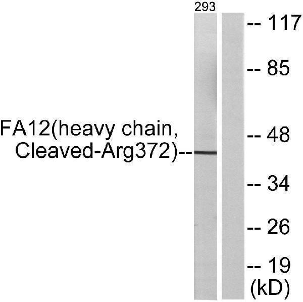 Western blot analysis of lysates from 293 cells, treated with etoposide 25uM 1h, using FA12 (heavy chain, Cleaved-Arg372) Antibody
