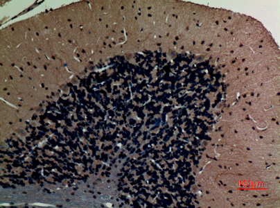a01227 abcg1 primary antibodyes ihc testing 2