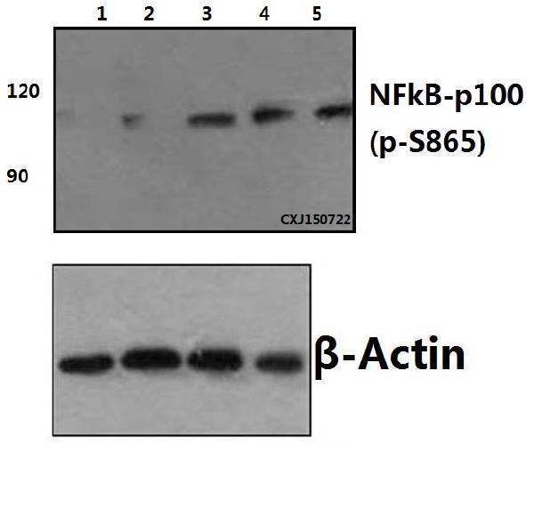 a01228s865 1 nfkb2 primary antiboties wb testing 1