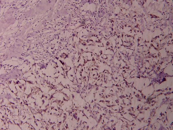 a01228s865 nfkb2 primary antiboties ihc testing 2