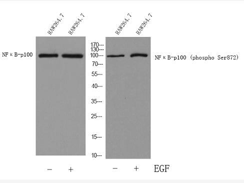 a01228s872 nfkb2 primary antibodies wb testing 1