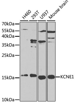 a01229 kcne1 primary antiboties wb testing 1