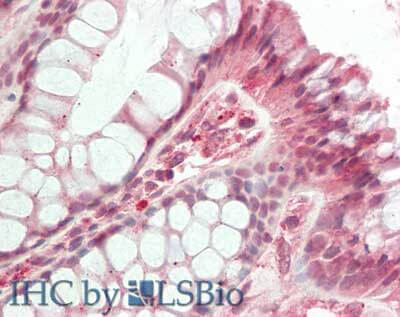 Immunohistochemistry of Rabbit anti-HDAC5 antibody