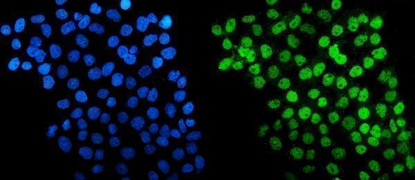 a01230 6 hdac5 primary antibodies if testing 8