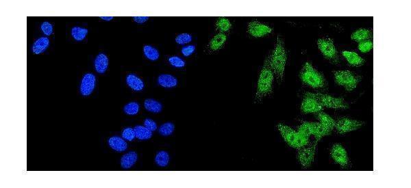 a01230 6 hdac5 primary antibodies if testing 9