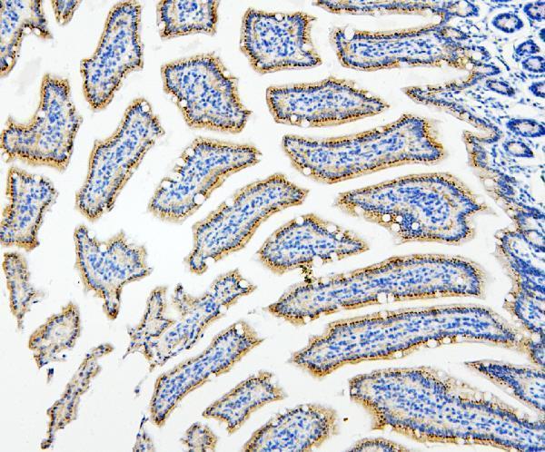  IHC analysis of HDAC5 using anti-HDAC5 antibody (A01230-6)