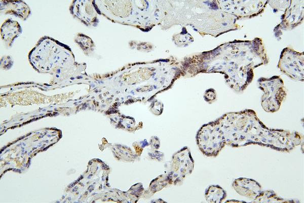  IHC analysis of HDAC5 using anti-HDAC5 antibody (A01230-6)