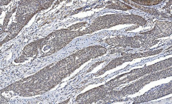a01230 6 hdac5 primary antibodies ihc testing 4