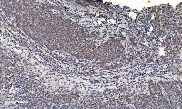a01230 6 hdac5 primary antibodies ihc testing 5