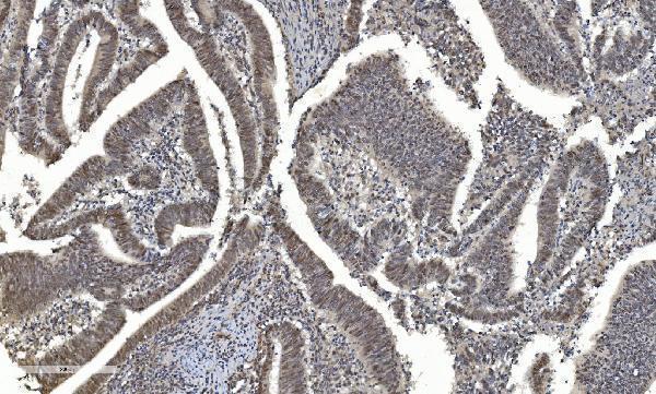 a01230 6 hdac5 primary antibodies ihc testing 6