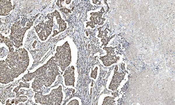 a01230 6 hdac5 primary antibodies ihc testing 7