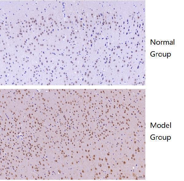 a01230 6 hdac5 primary antibodies ihc testing 7